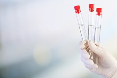 Óleo de transformador: ficar com mineral ou mudar para sintético?